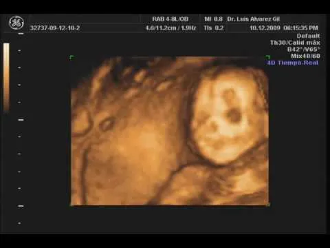 21 semanas de embarazo - YouTube