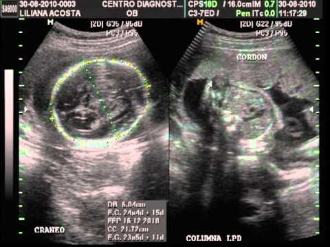 MI BeBe.. Ultrasonido 7 meses - YouTube