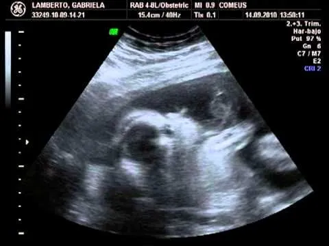 ecografia 2D y 4D de 23 semanas de embarazo - YouTube