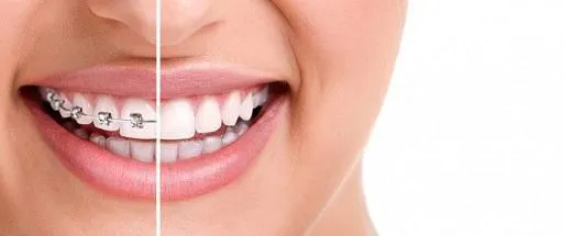 Endodoncias, ortodoncia, periodoncia, implantes, brackets ...
