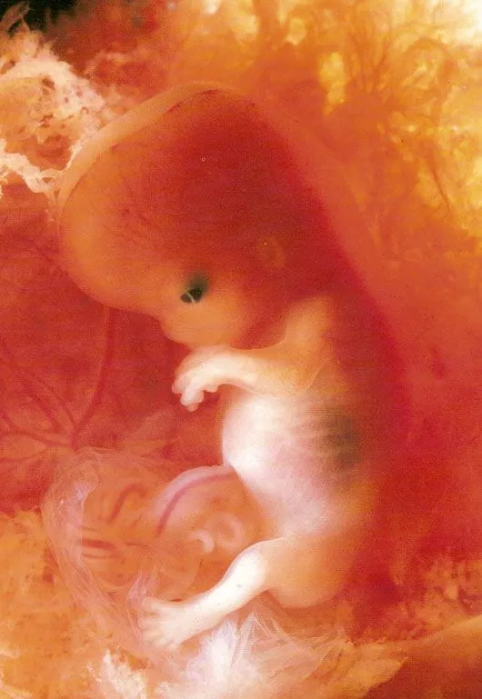 Imágenes edad gestacional | Aborto. La información médica