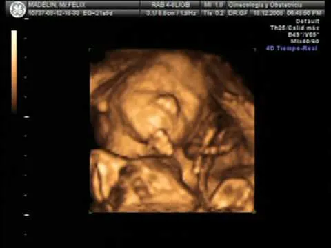 Madelyn Felix,Ecografia 20 semanas de embarazo - YouTube