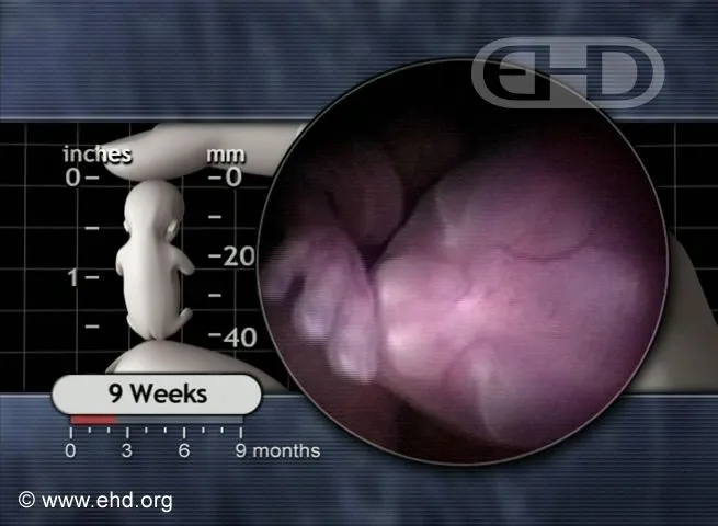 the-9-week-fetus.jpg