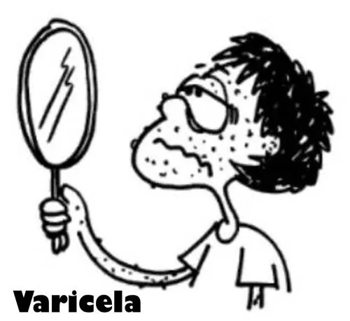 VARICELA DIBUJOS PARA COLOREAR | Dibujos para colorear