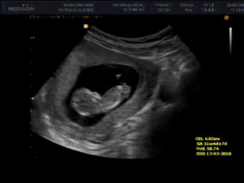 11SEMANAS on Veengle