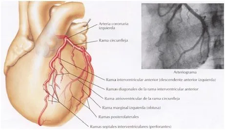 Anatomía del Corazón: Vascularización del Corazón