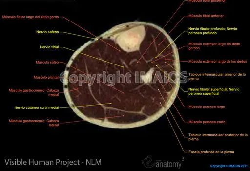 Atlas de anatomía humana : Visible Human Project (Pierna)