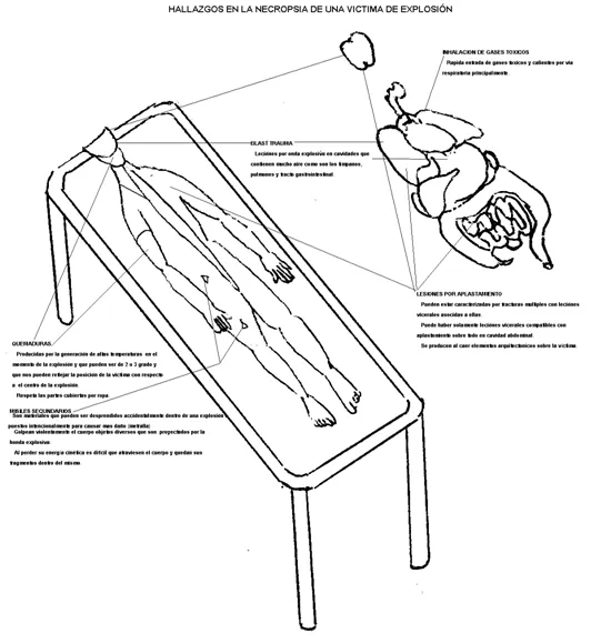 Atlas de medicina forense (página 2) - Monografias.com