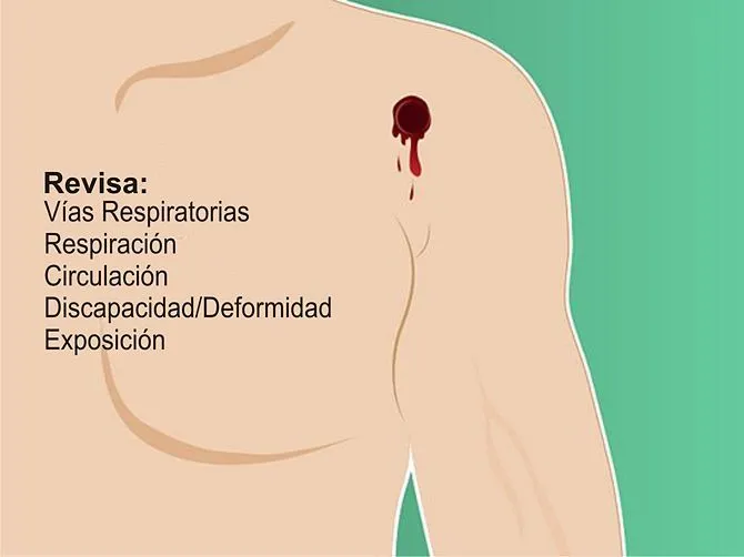 Primeros auxilios para una herida de bala - Taringa!