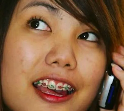 Bling-Bang-Blog | I want some hello kitty braces! vicemag: Deadly...