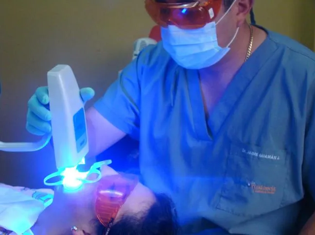 LA BOCA Y SUS PARTES: BLANQUEAMIENTO DENTAL