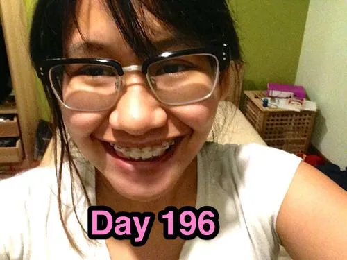 Braces Diary: Brace Yourself - Day 196: Thoughts - Day 196: Thoughts