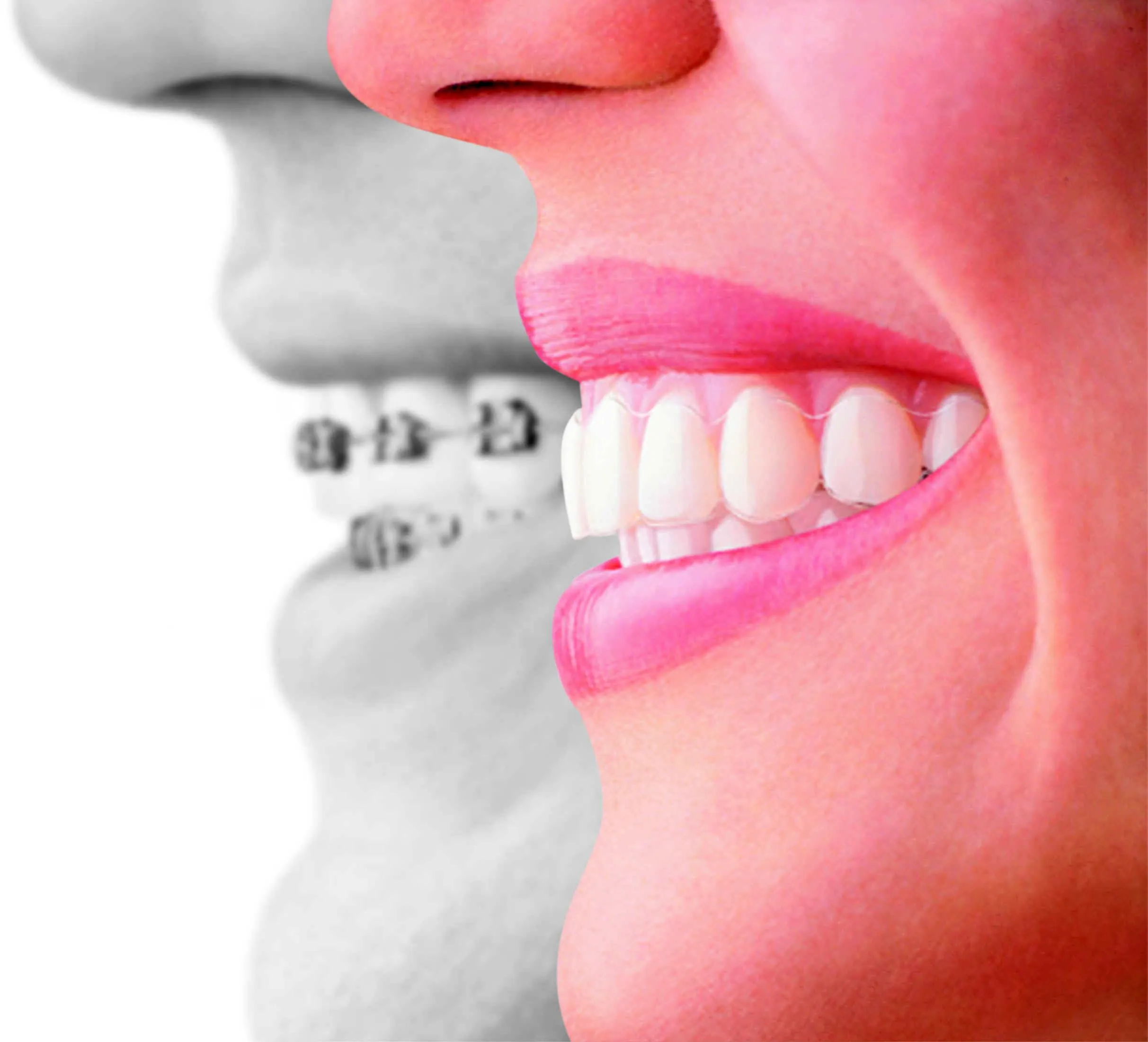 DIBUJOS CON BRACKETS - Imagui