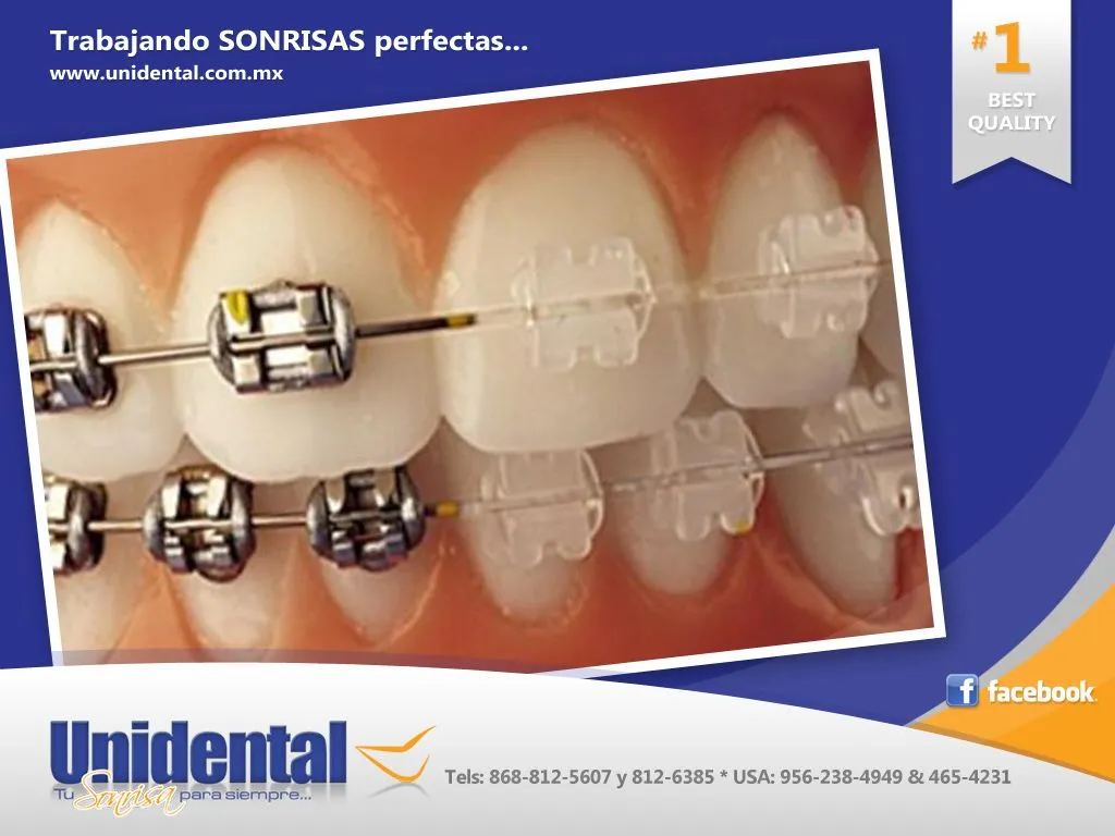 Brackets tradicionales o estéticos? | Bellas Sonrisas y Dientes ...