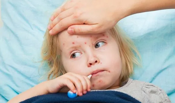 Brote de sarampión - Canal 4 San Juan - Argentina