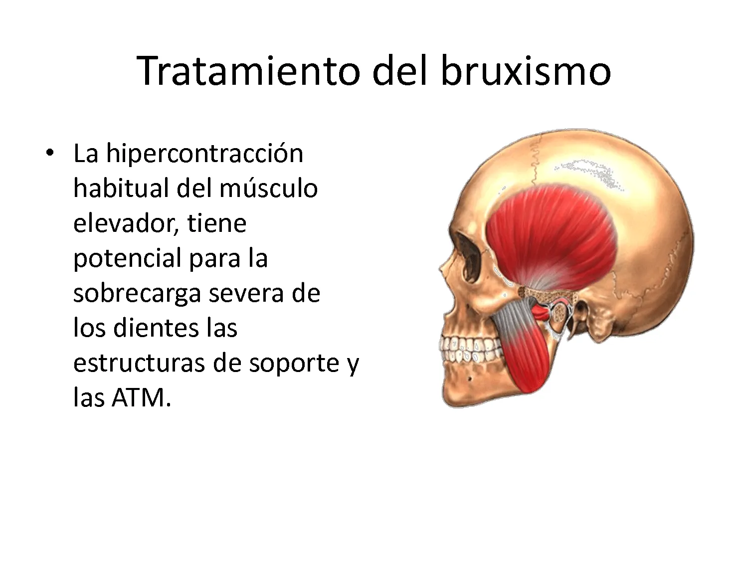 Bruxismo – Cuando se aprietan los dientes | desQbre Majadahonda