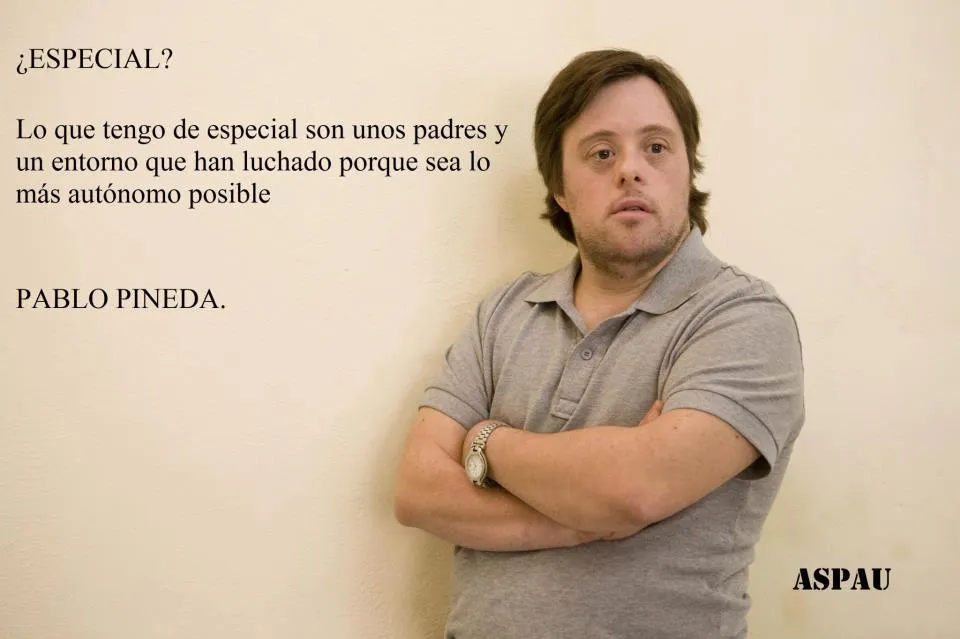 La boca que si calla explota: Síndrome de Down