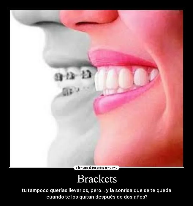 Carteles de Brackets Pag. 5 | Desmotivaciones