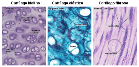 El cartílago - tejido cartilaginoso - Escuelapedia - Recursos ...