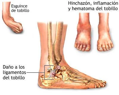 cdc Trajano de Utrera: septiembre 2012