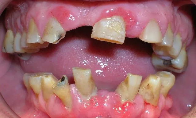 Cepillado de dientes, técnica, arte y devoción