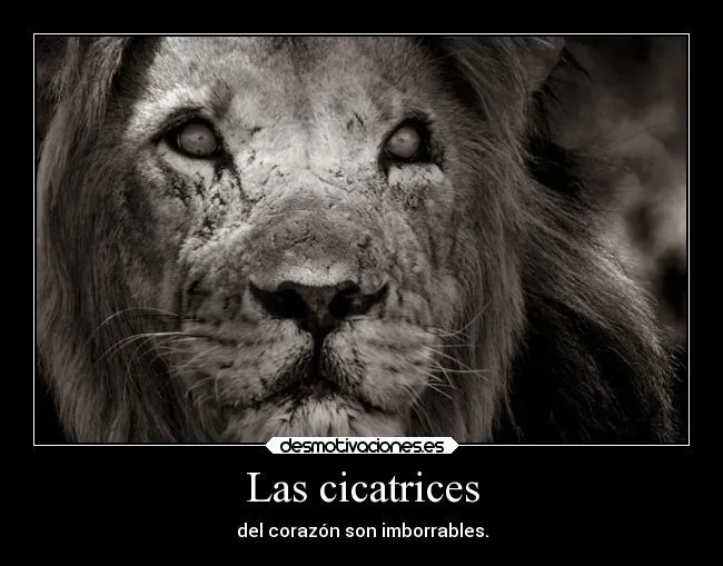 Las cicatrices | Desmotivaciones