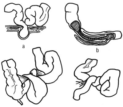 Cirugia y Anestesia | MedWebstudents | Página 6