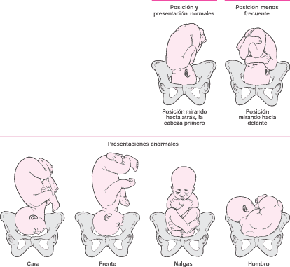 Cuándo se coloca en posición el bebé para el parto? | Preguntas ...