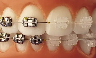 Consultorios Odontológicos Ortodoncia en San Miguel