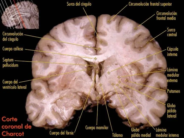 Cortes Cerebro