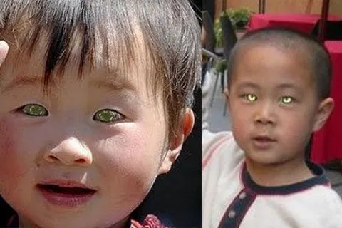 cOsAsDiveRTIdAs:201728) Nong Youhui, el nene chino que puede ver ...