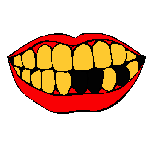 Dibujo de Boca y dientes pintado por Caries en Dibujos.net el día ...