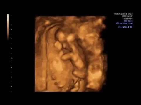 Ecografía 4D, feto de 9 semanas y 2 días - YouTube