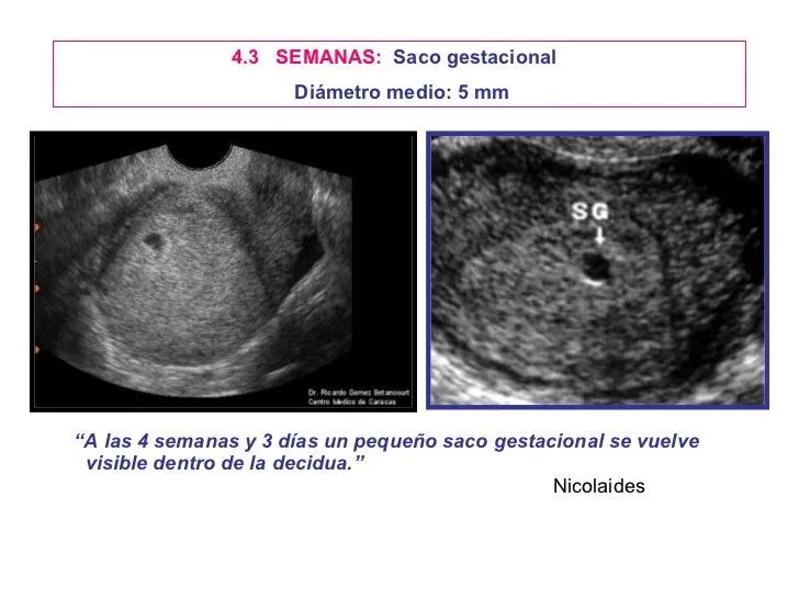 embriosonografa-28-728.jpg?cb= ...