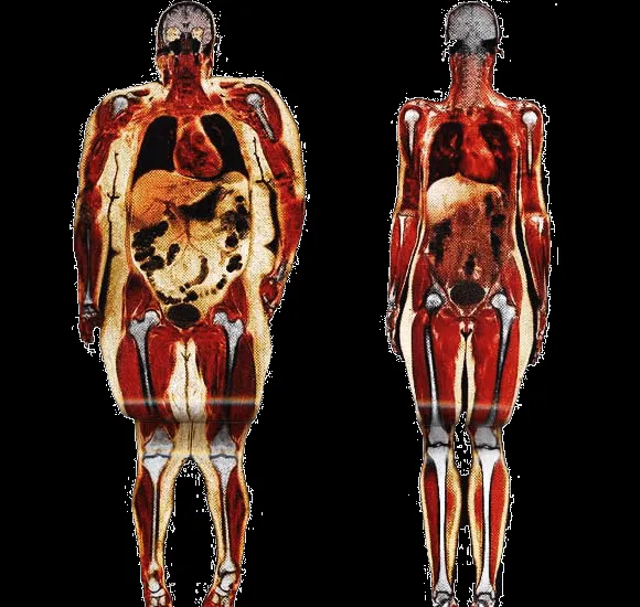 Más que Solo Ensalada: ¿Cómo se ve tu cuerpo por dentro?