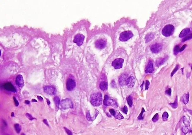 Epitelial: transición. Atlas de Histología Vegetal y Animal