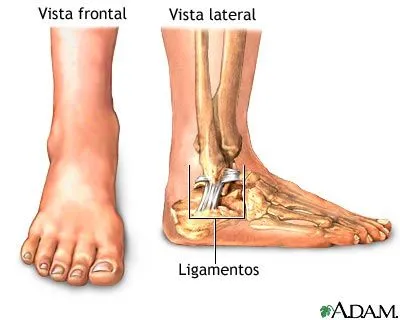 ESPECIALIDAD-MEDICA "USMP": ESGUINCE:ESGUINCE DE TOBILLO