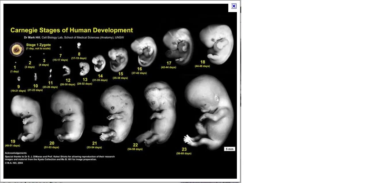 ESTIMULACION PRENATAL: DESARROLLO FETAL