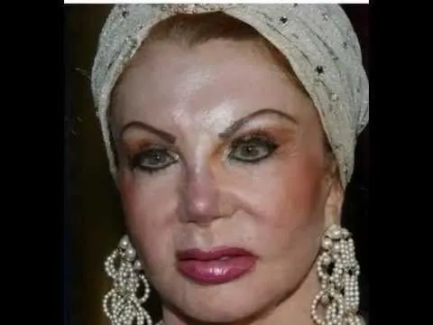 Famosos que arruinaron sus caras con cirugías - YouTube