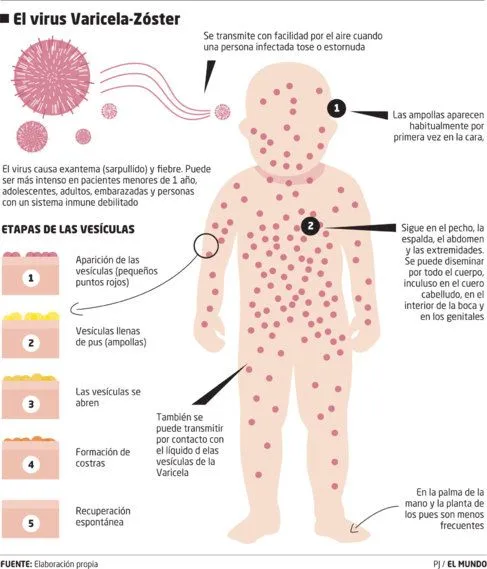 Las farmacias aconsejan no comprar la vacuna de la varicela de ...