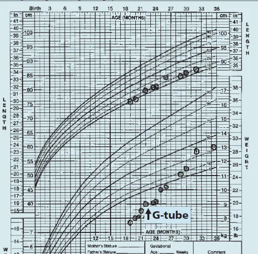 Fibrosis Quística en México: marzo 2011