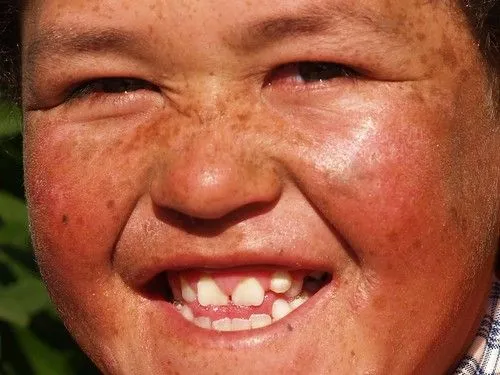 Flickr: Discussing 5to Concurso...... NIÑOS SONRIENDO...... (Ganó ...