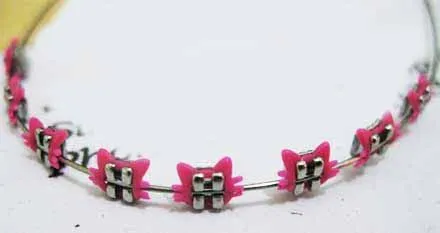 Hello Kitty Braces | Hello Kitty Hell