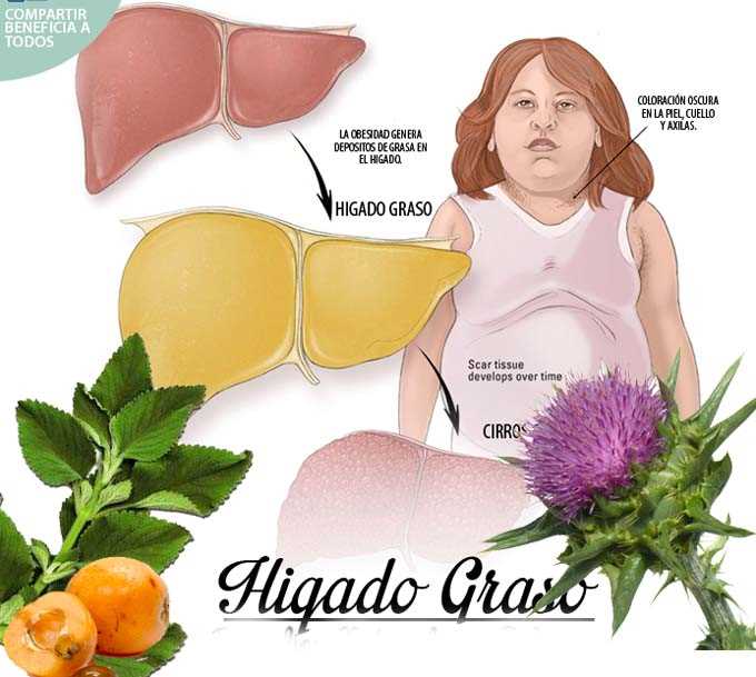 Que es bueno para el hígado graso - Buena Salud