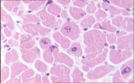 HISTOLOGIA: tejido cardiaco