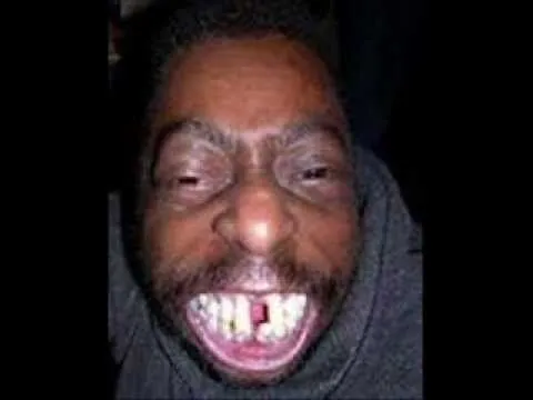 El hombre mas feo del mundo 2012 - Imagui