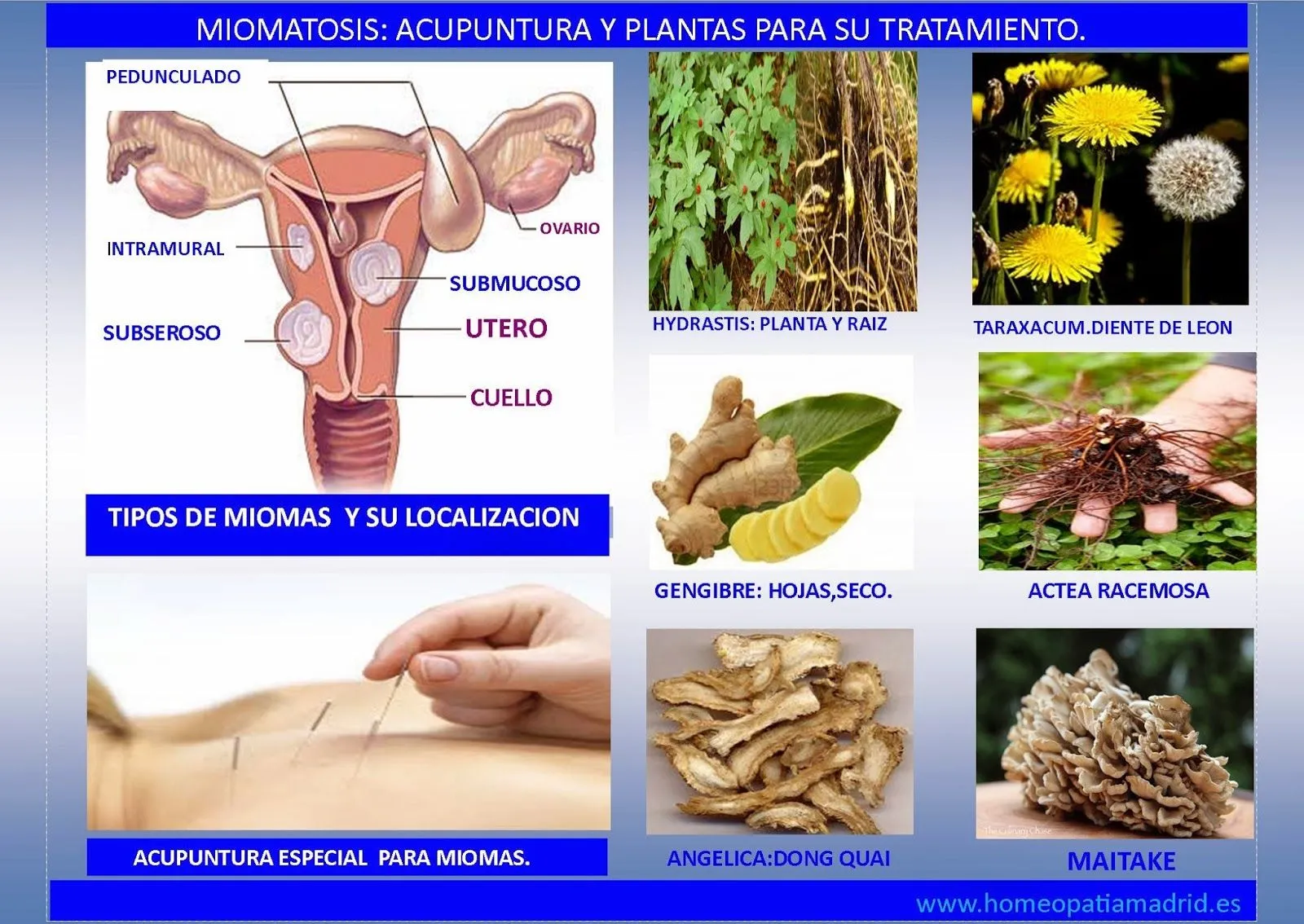 HOMEOPATIA MADRID: MIOMAS UTERINOS, GENES, PLANTAS Y ACUPUNTURA.