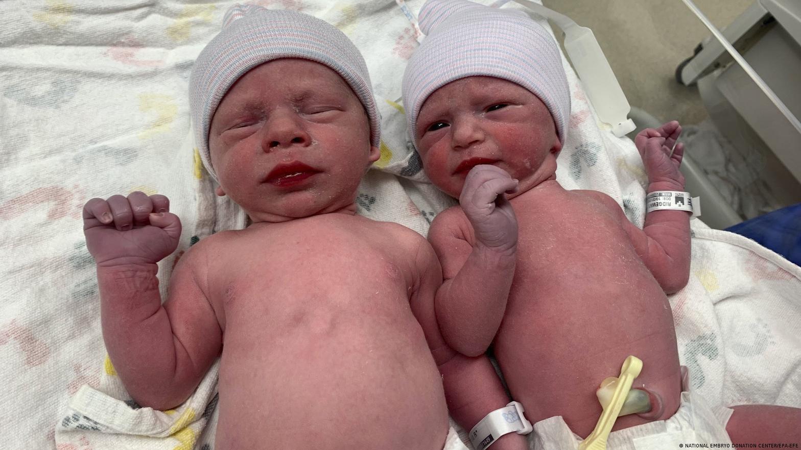 Hospital de California reporta nacimiento de 10 pares de gemelos en un día – El Nuevo Diario (República Dominicana)