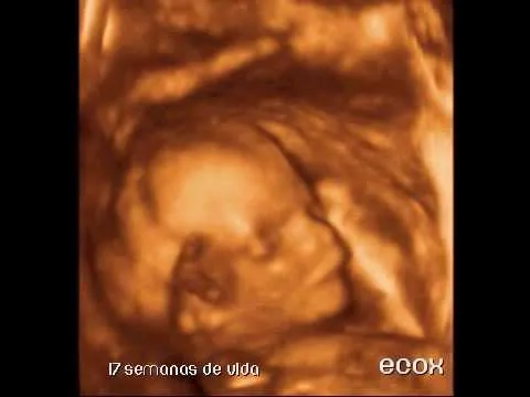 Ecografia de 17 semanas - Imagui