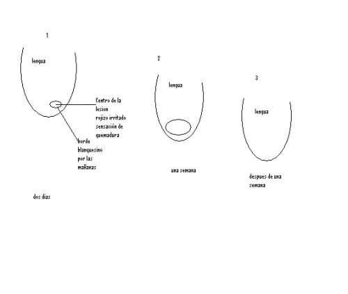 Como dibujar la lengua - Imagui